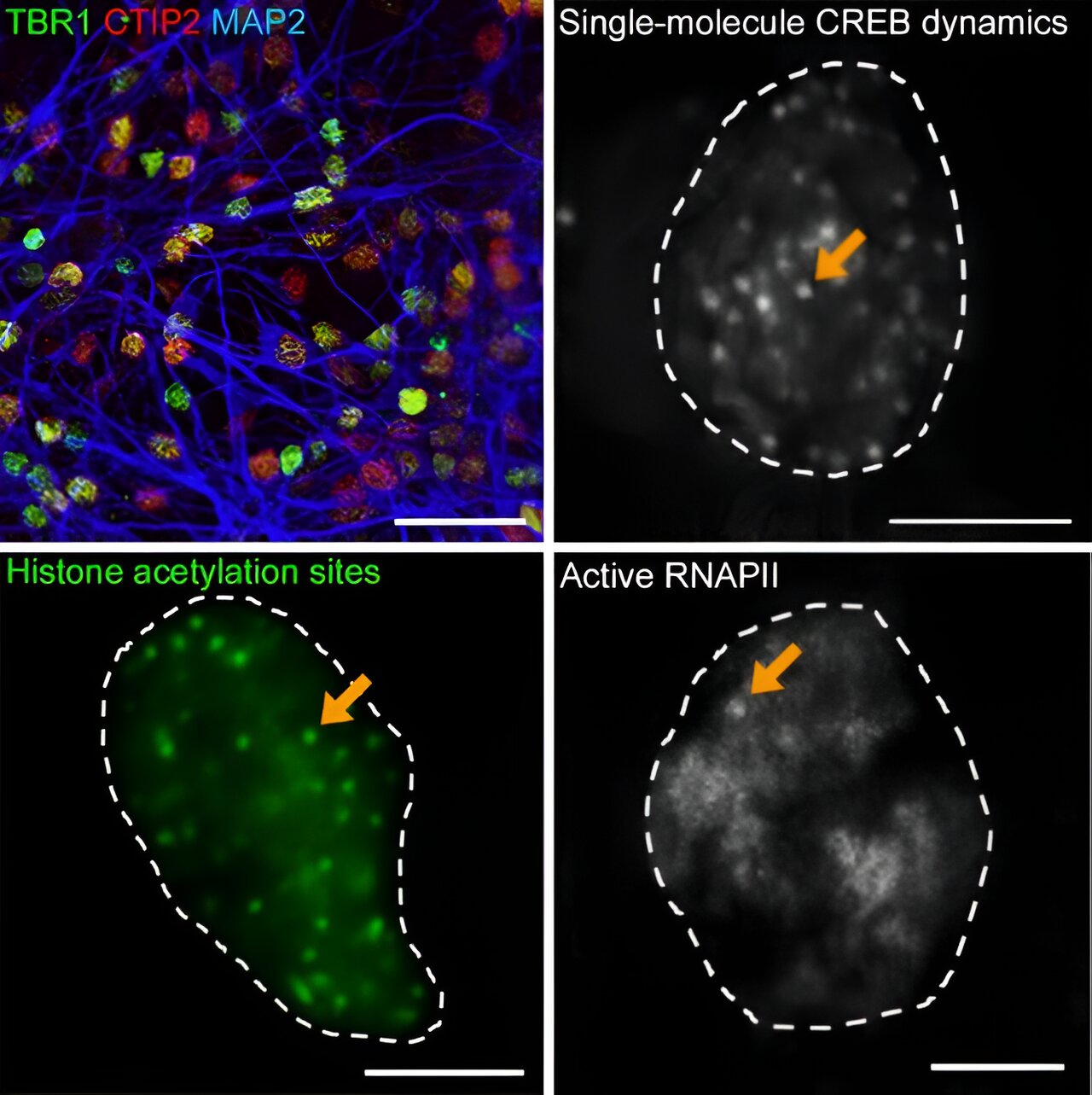 Histone acetylation, transcription factor dynamics contribute to gene expression in brain development
